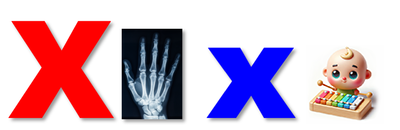 X